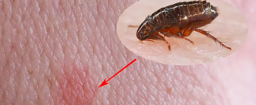 Flea Control for Humans Carlsbad, CA